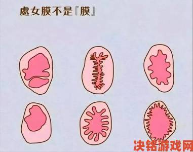 中指进入一半膜会破吗？深度解析女性身体构造的敏感问题